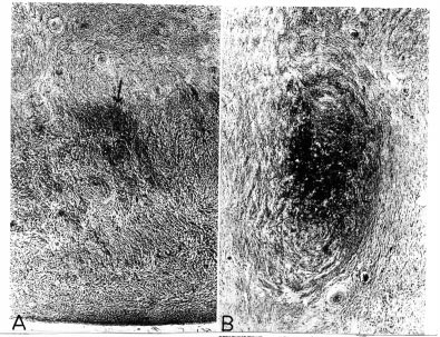 Cellular and Molecular Biology of Human Oogenesis, Ovulation and Early Embryogenesis